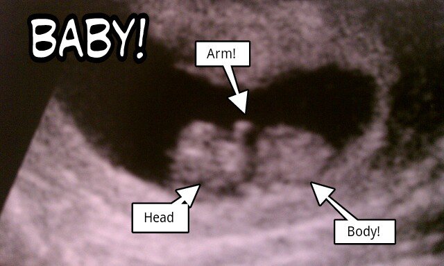 Baby Ultrasound Announcement