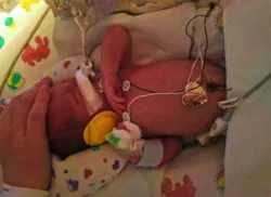 NICU Baby Arlo 1